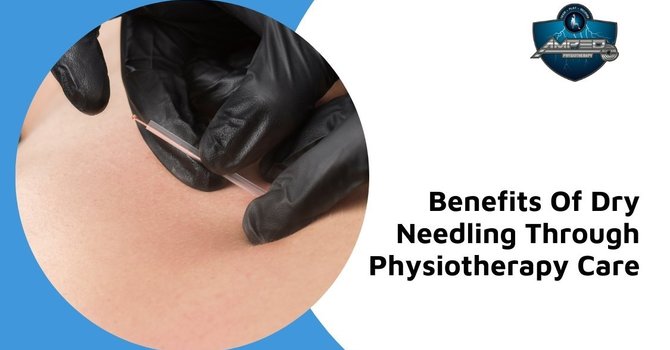 7 Real Benefits Of Dry Needling Through Physiotherapy Care