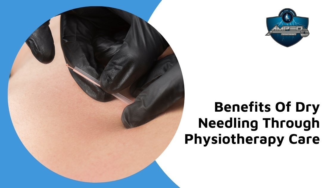 Dry needling for physical therapy ottawa