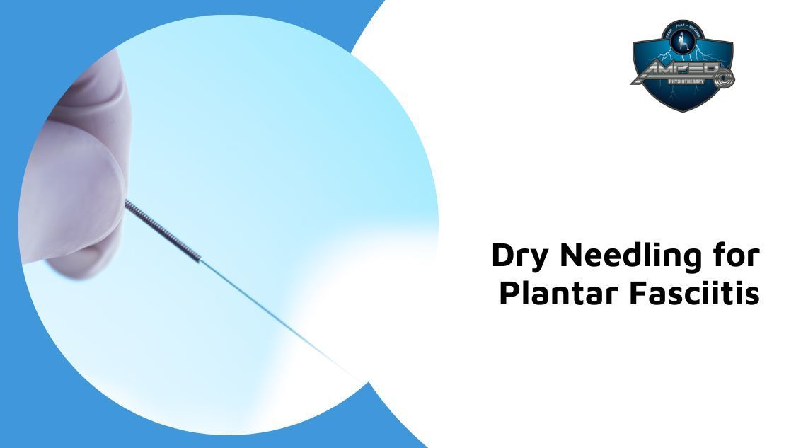Dry needling for plantar fasciitis ottawa