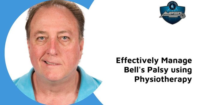 Effectively Manage Bell's Palsy using Physiotherapy image