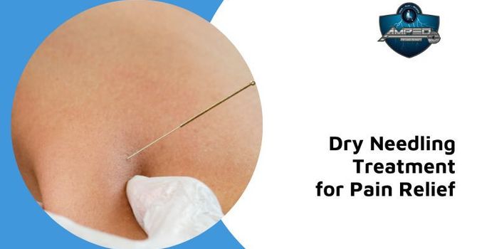 Dry Needling for Pain Relief: What It Is and How It Works image