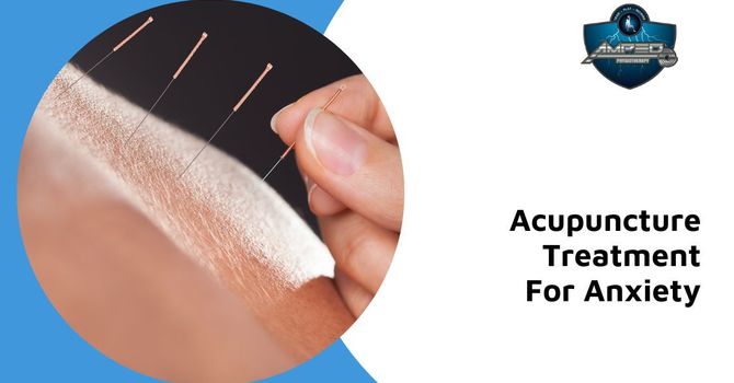 How Acupuncture Can Help Reduce Symptoms of Anxiety