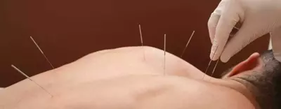 Link to: https://ampedphysiotherapy.com/services/acupuncture-ottawa