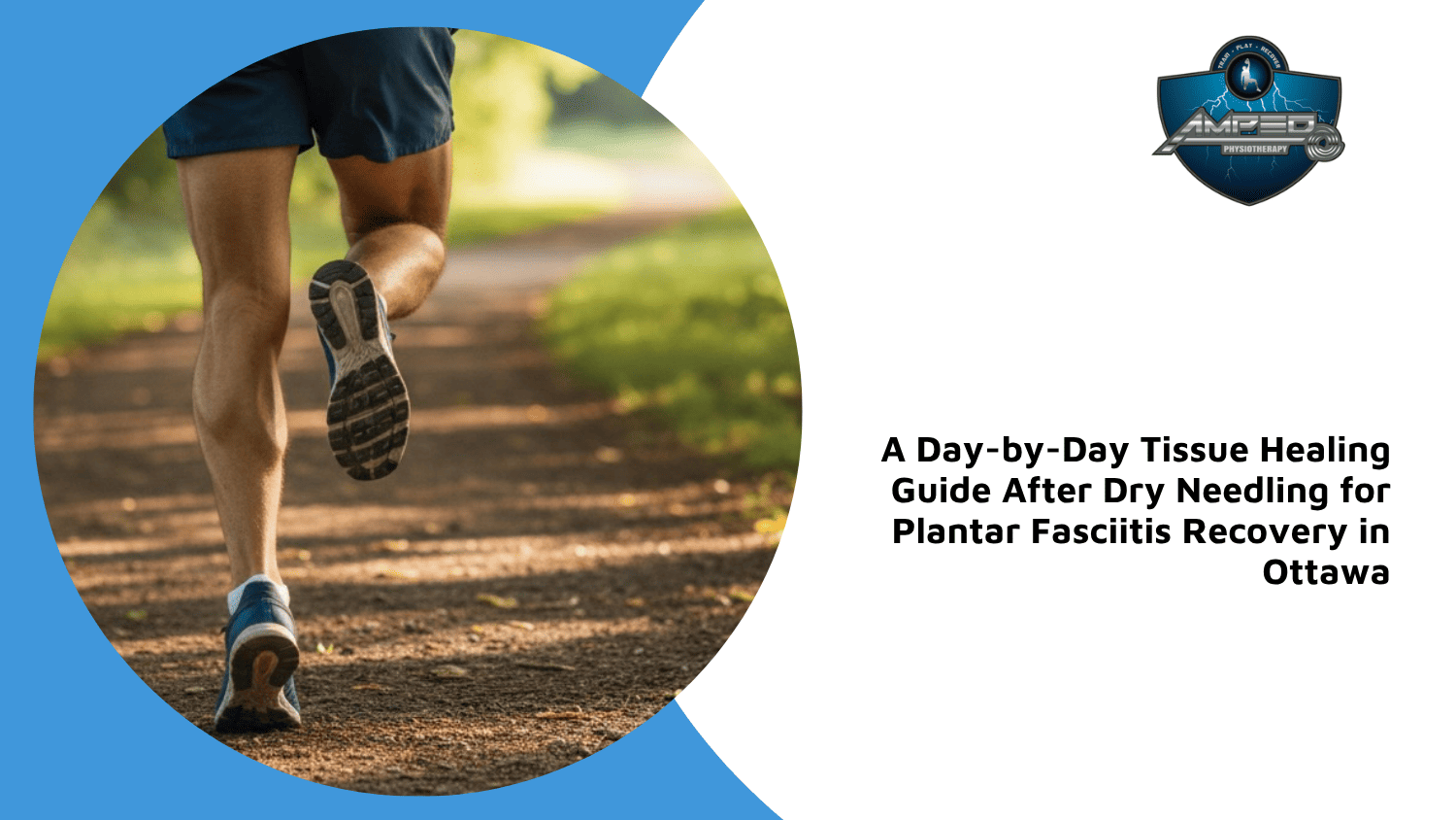 day by day tissue healing dry needling plantar fasciitis recovery ottawa